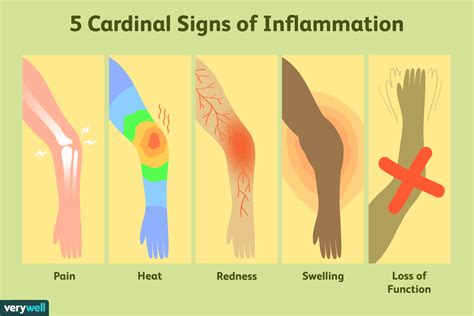 inflamed meaning.